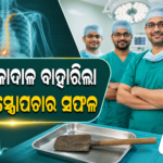 ଭୀମ ଭୋଇ ମେଡିକାଲ କଲେଜରେ ବିରଳ ଅସ୍ତ୍ରୋପଚାର; ଚାଷୀଙ୍କ ଛାତିରୁ କୋଦାଳ ବାହାରିଲା